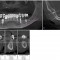 Dreidimensionale Implantatplanung im Unterkiefer